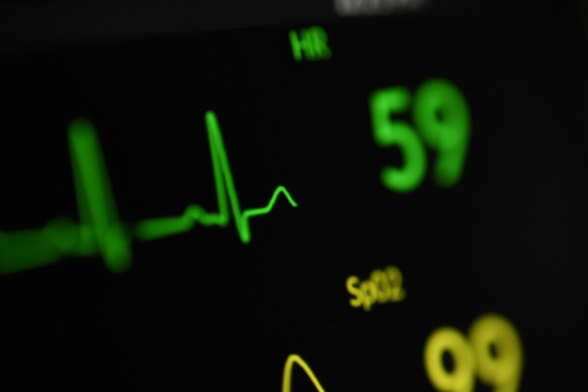 1. Ce este EKG - ce este electrocardiograma, istoricul și importanța sa
