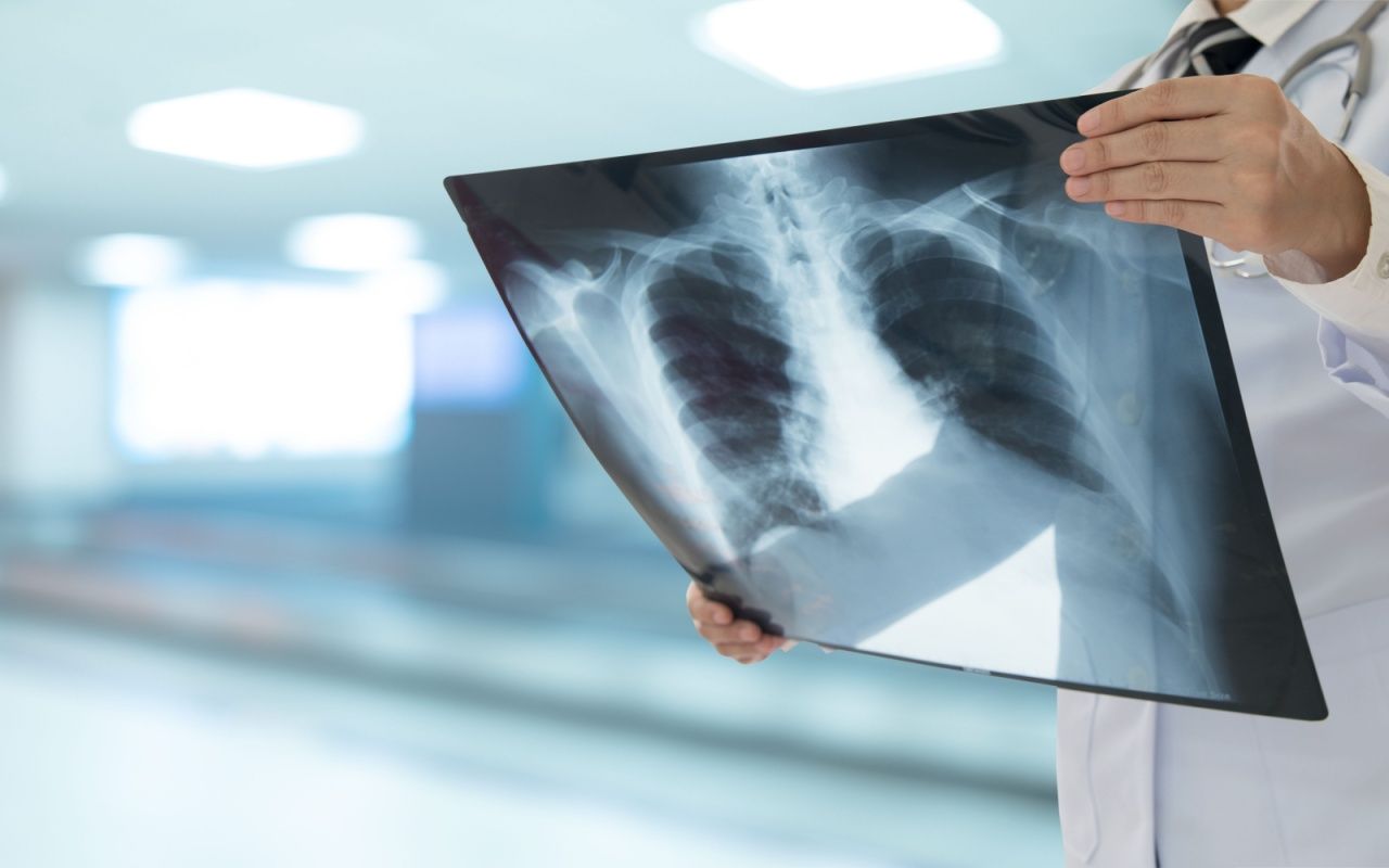 1. Diagnosticarea BPOC - metode și stadii ale bolii