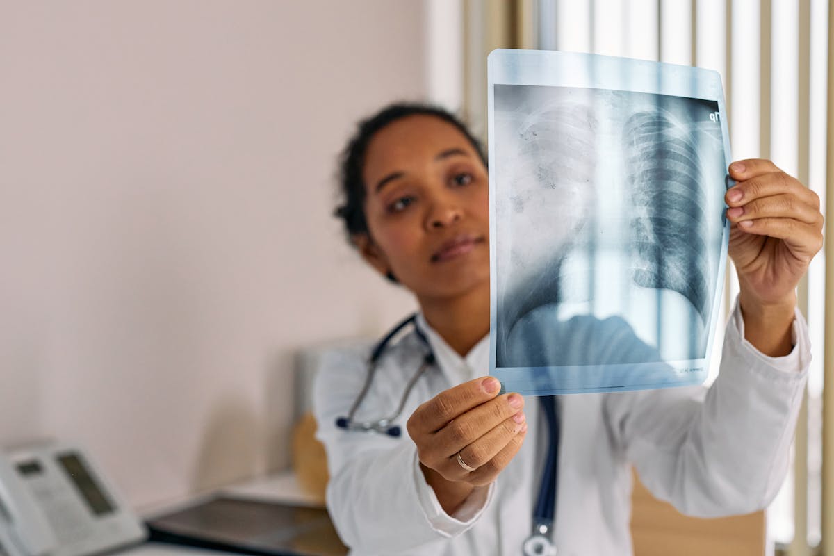 3. Embolia pulmonara si investigațiile specifice-aparatura necesara pentru a se putea pune un diagnostic si interveni prompt_doctor uitandu-se pe radiografie toracica