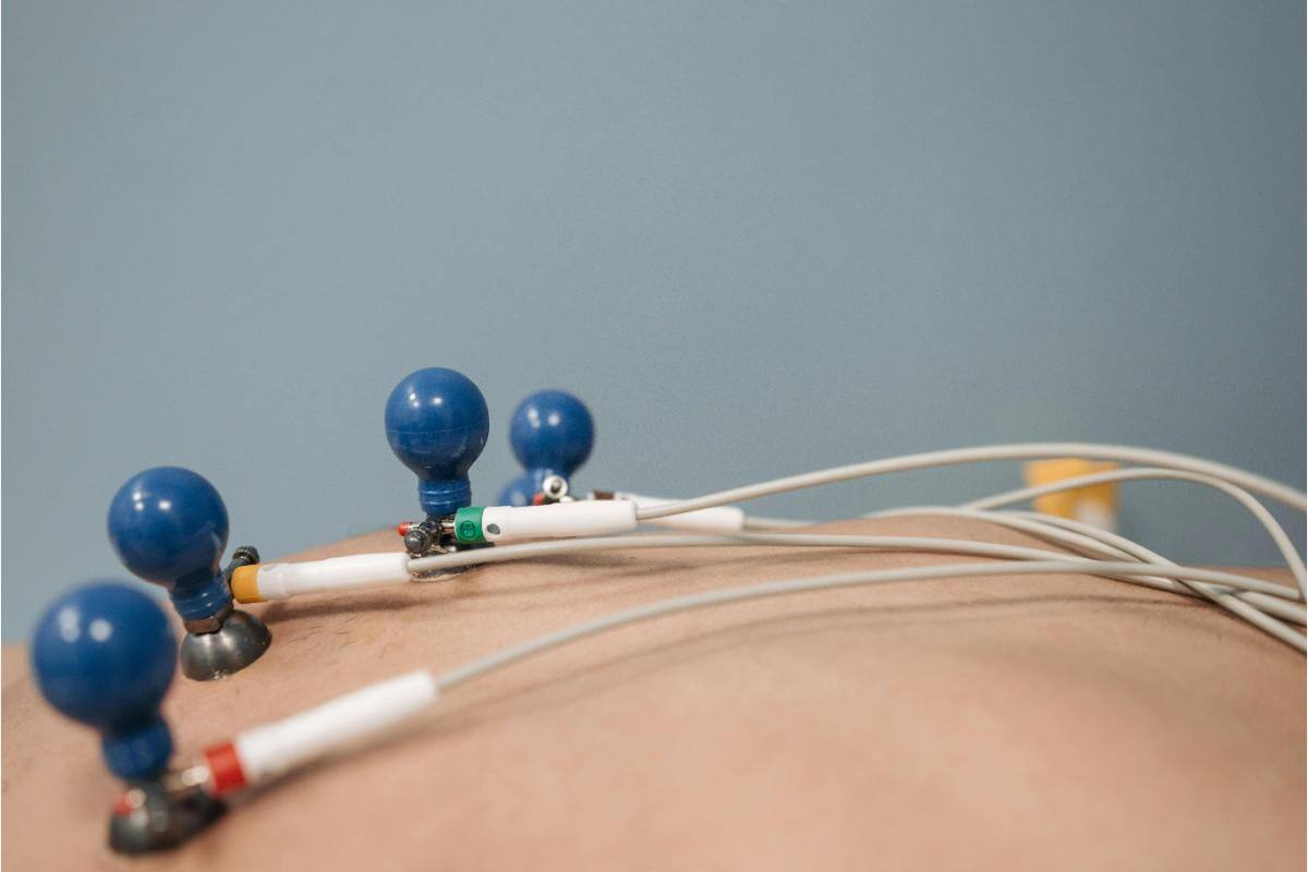 Ce inseamna Holter EKG Analiza rolului sau esential in prevenirea afectiunilor cardiace