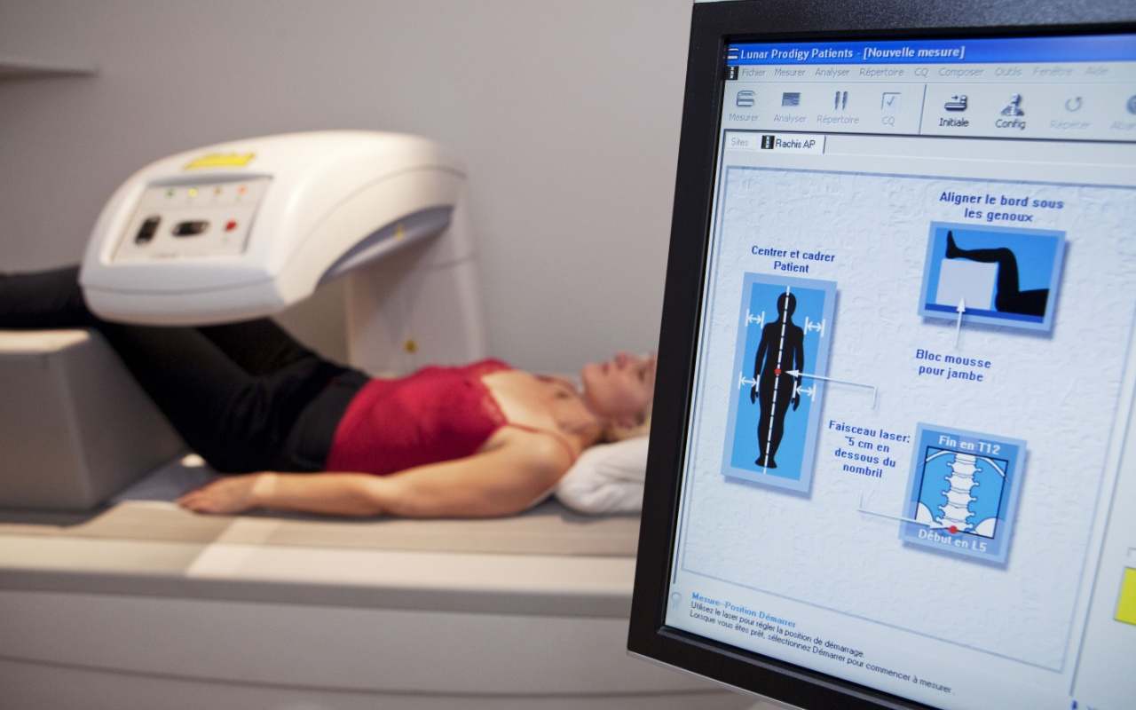 Osteodensitometrie - Analiza DEXA pentru diagnosticul osteoporozei