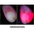 Dermatoscop DermLite Foto X + Nailio