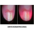 Dermatoscop DermLite Foto X + Nailio