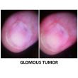 Dermatoscop DermLite Foto X + Nailio
