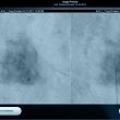Dermatoscop digital MoleMax HD