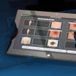 Dermatoscop MoleMax HD PRO