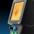 Dermatoscop MoleMax HD MODULAR