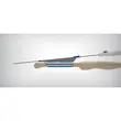 Sistem de ablatie cu radiofrecventa pentru tratamentul fibromului uterin Myoblate