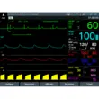 Defibrilator profesional multifunctional defiMASTER
