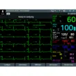 Defibrilator profesional multifunctional defiMASTER