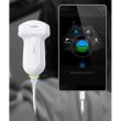 Ecograf portabil Philips Lumify