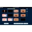 Dermatoscop SkinDOC
