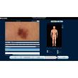 Dermatoscop SkinDOC