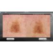 DermDOC HR