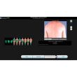 Dermatoscop MoleMax HD AMTBM