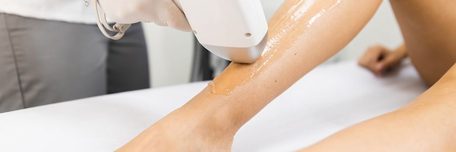 Laser sau IPL? Care este principala diferență dintre cele două metode de epilare definitivă?