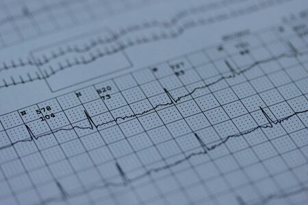 Ce este EKG, cum se face și cum se interpretează rezultatele?