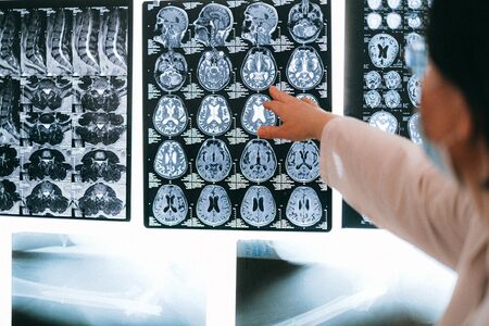 Boli neurologice – descoperă patologiile cu prevalență semnificativă în rândul pacienților afectați de disfuncții ale sistemului nervos