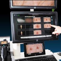 Dermatoscop MoleMax HD PRO